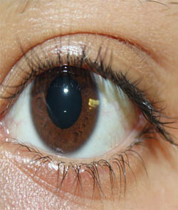 Lenses and Frames