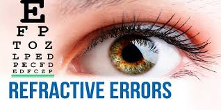 Post operative lasik care